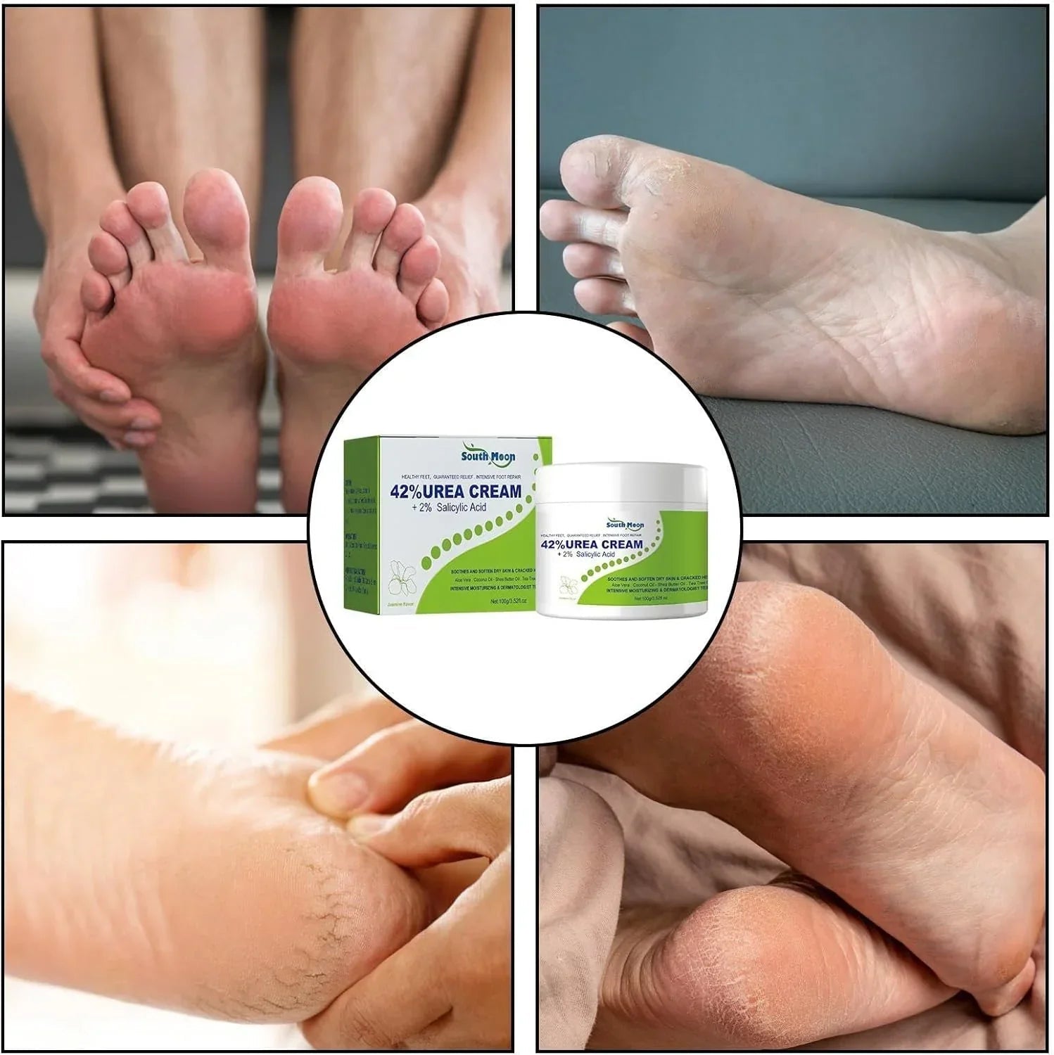 South Moon - 42% Urea Cream + 2% Salicylic Acid (Original) - NeoxMart Store