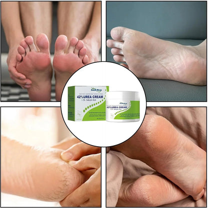 South Moon - 42% Urea Cream + 2% Salicylic Acid (Original) - NeoxMart Store
